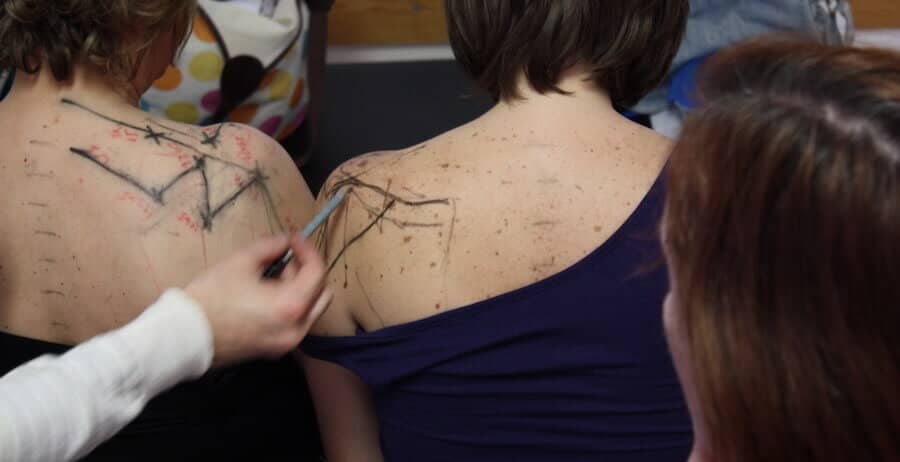 pontos de acupuntura no ombro