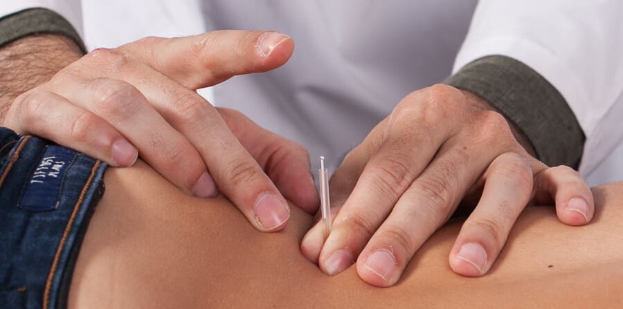 acupuntura na dor