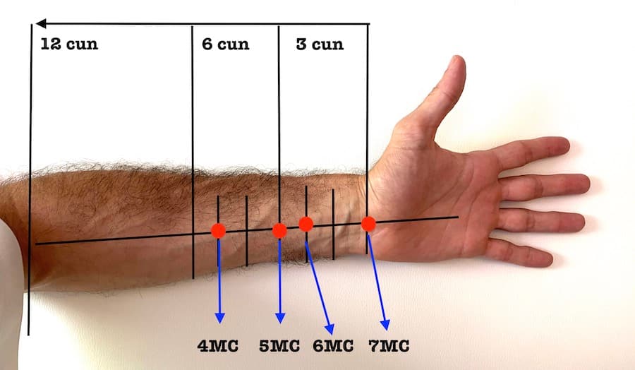marcos anatómicos e sistema de cun no braço